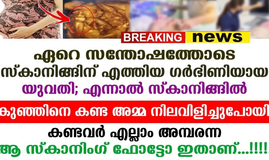 കുഞ്ഞിന്റെ അസഹനീയമായ ചവിട്ടലുകളും പ്രതികരണങ്ങളും ഗർഭിണിയായ യുവതി സ്കാനിങ്ങിൽ കണ്ടത് ആരെയും ഞെട്ടിക്കുന്ന ഒരു കാഴ്ച