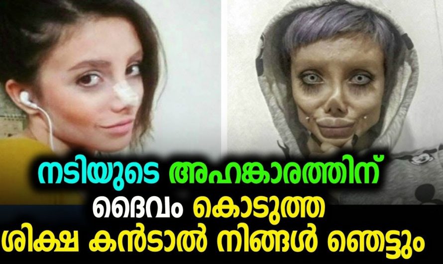 ആരാധന മൂത്ത് ഇത്രയധികം ശാസ്ത്രക്രിയകൾ വേണ്ട എന്നായിരുന്നു ആരാധകരുടെ തന്നെ അഭിപ്രായം ഇപ്പോൾ കണ്ടാൽ പേടിപ്പെടുത്തുന്ന രൂപവും