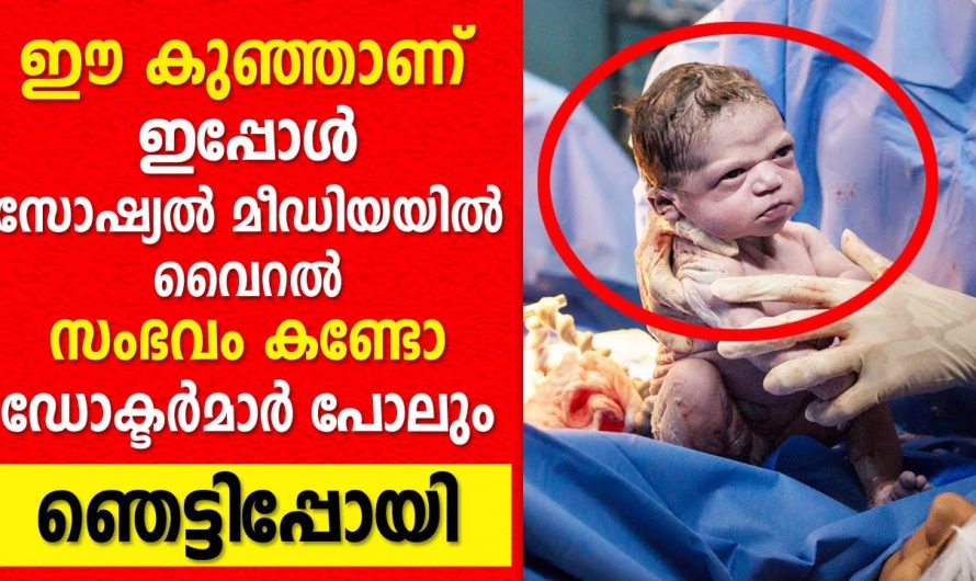 പുറത്തെടുത്ത ഡോക്ടറോട് തന്നെ കട്ട കലിപ്പായി  നവജാതശിശു