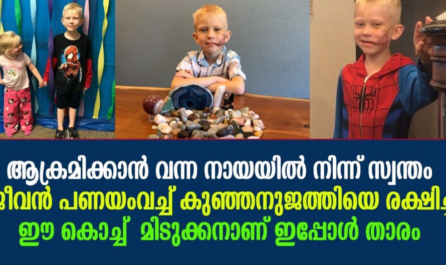 ആ കുഞ്ഞു പയ്യനെ നായ കടിച്ചു കീറി എന്നാൽ പിന്നീട് ഉണ്ടായത് ആരെയും വെട്ടിക്കുന്നത്