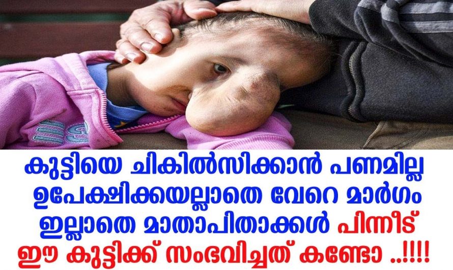 ചികിത്സിക്കാൻ നിവൃത്തിയില്ലാത്തപ്പോൾ ആ കുഞ്ഞിനെ ഉപേക്ഷിക്കാൻ നിന്നതായിരുന്നു ആ മാതാപിതാക്കൾ എന്നാൽ പിന്നീട് സംഭവിച്ചത് കണ്ടോ