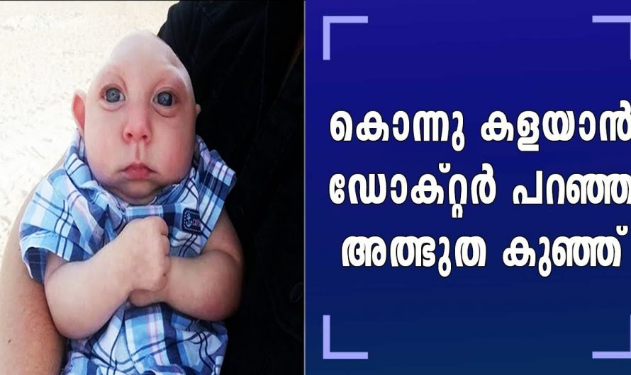 അധികകാലം ഇനി കുഞ്ഞ് ജീവനോടെ ഉണ്ടാകില്ല ആ മാതാപിതാക്കൾ അഞ്ച് വർഷമാണ് ജോലി ഉപേക്ഷിച്ച് അവനെ വേണ്ടി കാത്തിരുന്നത്