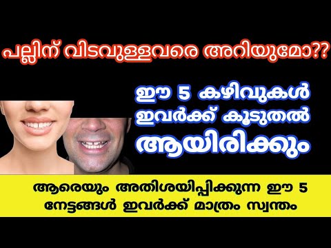 നിങ്ങളുടെ പല്ലുകൾക്ക് വിടവുകൾ ഉണ്ടെങ്കിൽ ഇത് അറിയാതെ പോകരുത്…