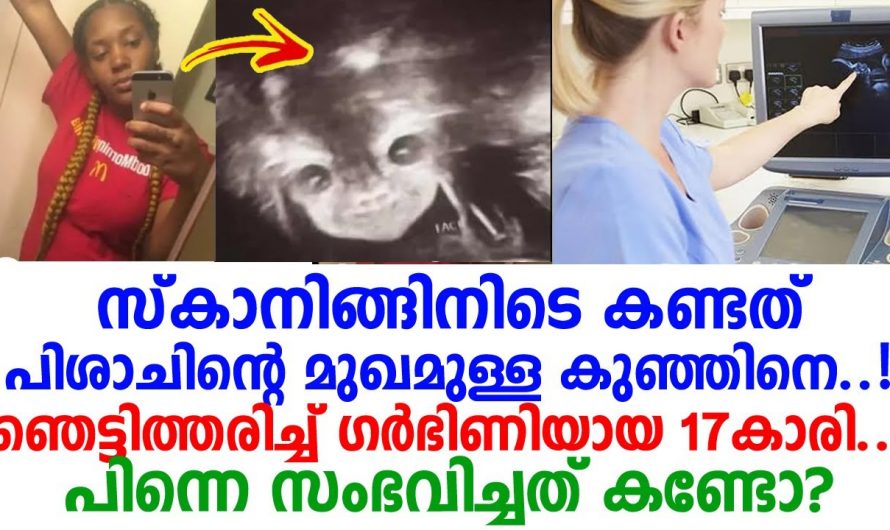 വിവരമില്ലായ്മ ഒരു കുറ്റമല്ല. നിങ്ങൾക്ക് ഇത്തരത്തിൽ ഒന്നും സംഭവിക്കാതിരിക്കട്ടെ..